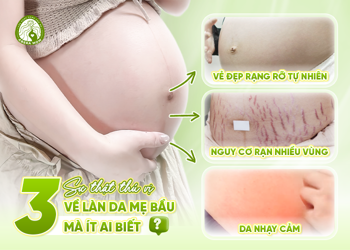 3 Sự thật thú vị về làn da mẹ bầu mà ít ai biết