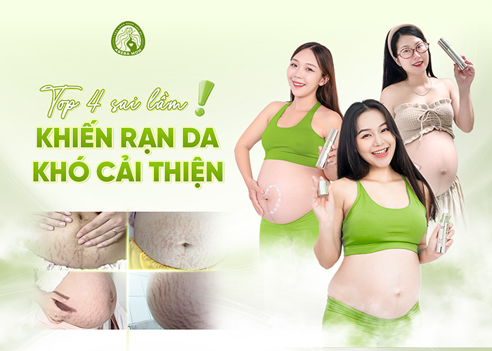 Top 4 sai lầm khiến rạn da khó cải thiện - Mẹ cần tránh để chăm sóc da hiệu quả