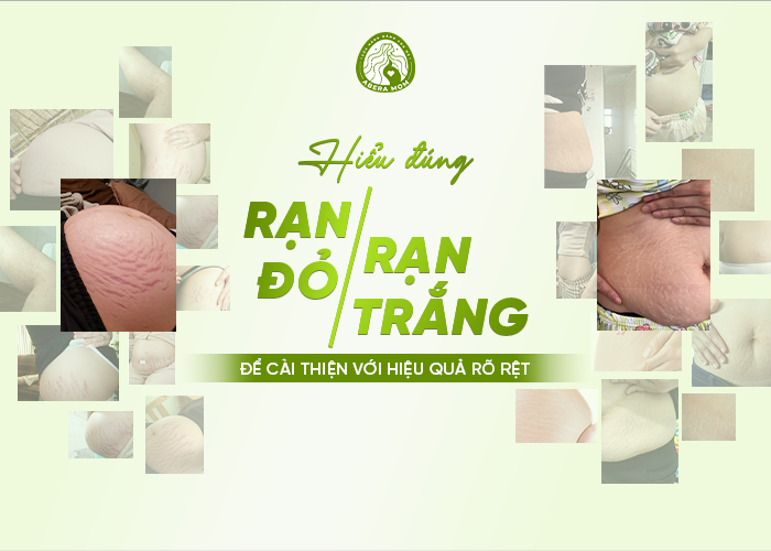 Hiểu rõ về rạn đỏ và rạn trắng để quá trình cải thiện hiệu quả hơn